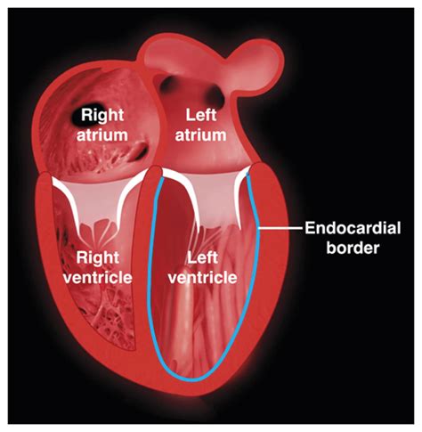 lv function of heart|picture of left ventricle heart.